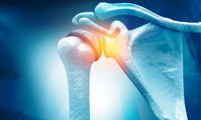 How to quickly heal following shoulder surgery using ice packs and other useful tips you need to know